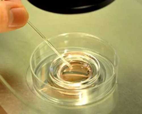 北京协和医院供卵试管权威解析：专业助孕与辅助生殖服务